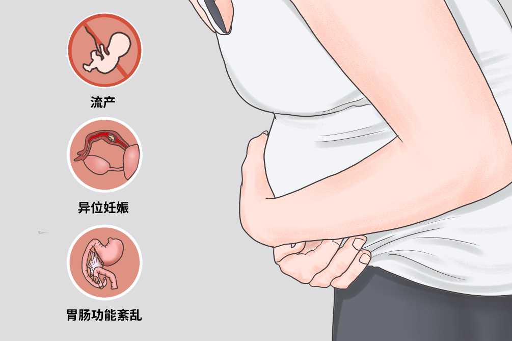 孕妇在孕中期出现左侧肋骨疼痛的因及解决方法