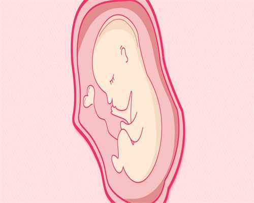 北海代孕：孕妇上腹部涨涨的，多数是这7个原因