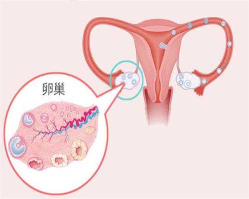 长治代孕网：孕妇不小心照到X光怎么办？孕妇需