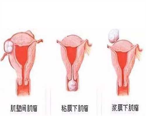 桂林哪里可以做代孕：孕妇做四维时的3个小秘密