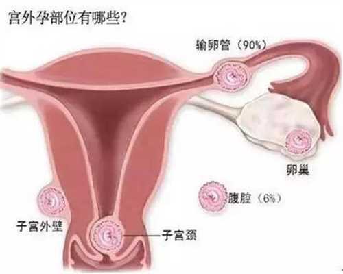深圳天使代孕是不是骗人的：先兆流产怎样科学