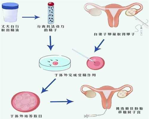 广州代孕包成功怀孕初期肚子是什么样的，这是