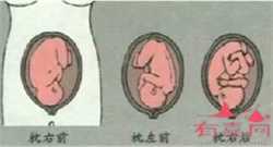 广州代孕哪家安全代怀孕初期都有什么症状？