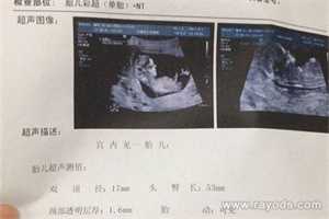 广州代孕价格代孕后，这4种水果蔬菜孕妇不要碰
