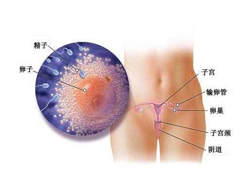 广州代孕成功率有多高,子宫发育异常的几种类型