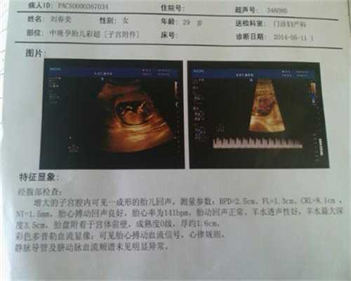 西藏借卵子生子中国允许吗-西藏代孕对血型有要