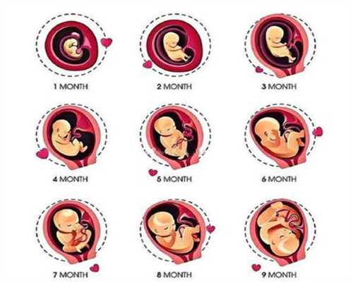 孕宝借卵子机构-孕宝代孕生殖专家宫外孕切除右