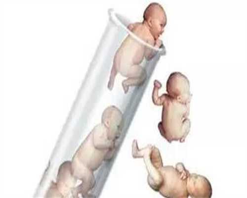 孕宝注射器助孕法孕宝试管可以要求男孩吗准妈