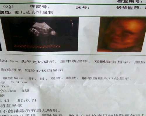 广州试管代孕婴儿男的检查项目~广州国外代生小