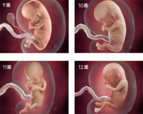 美国孕宝国际美国试管代孕婴儿前的检查项目宫