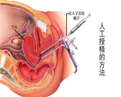 孕宝试管代孕婴儿网~孕宝提供卵巢早衰借卵代孕