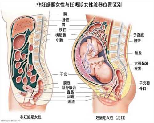 广州代孕-广州想做试管价钱-广州试管代孕筛选性