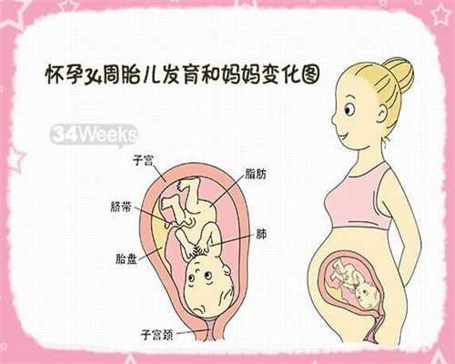 广州代孕_广州做代孕流程_广州2020代孕多少钱