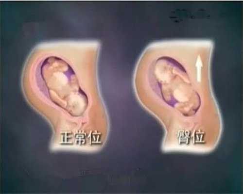 广州代孕~广州借卵生子dna~广州借卵子生子的孩子